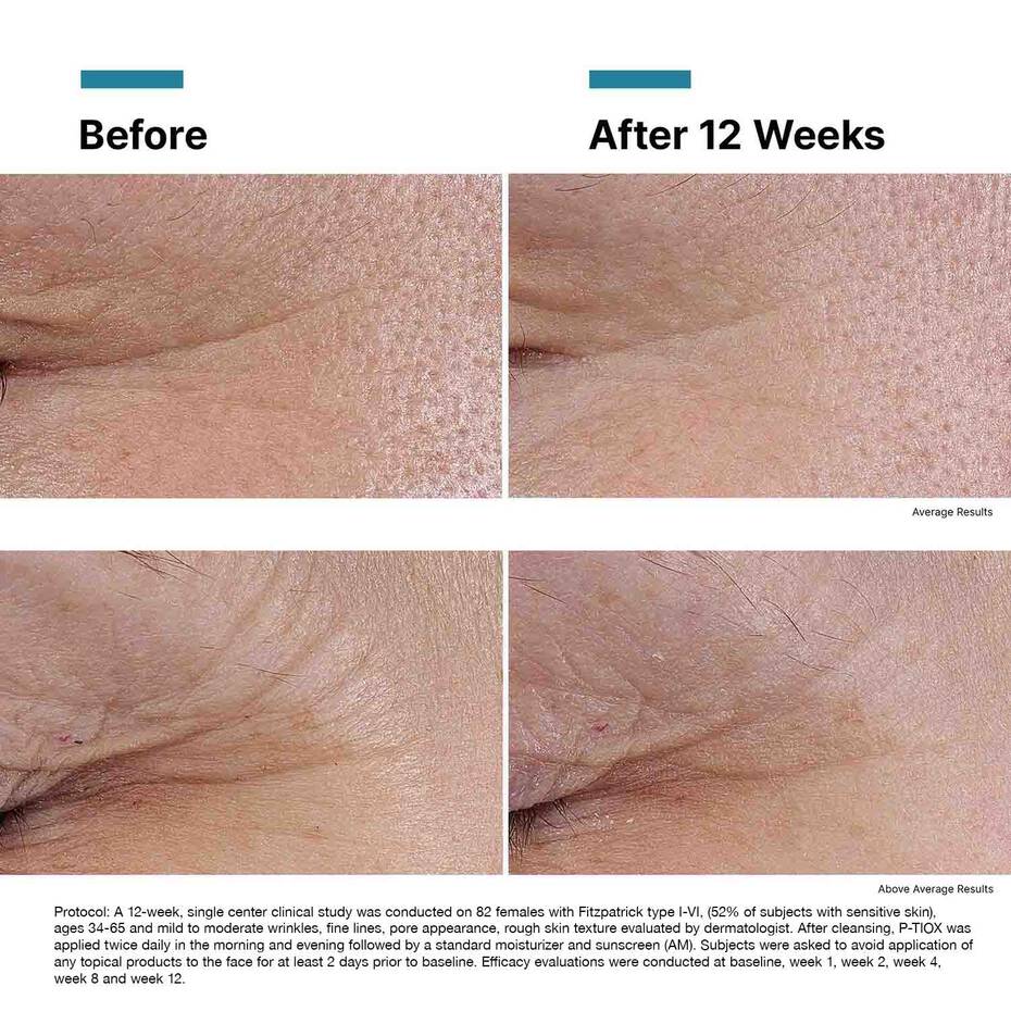 SkinCeuticals P-TIOX Peptide Serum