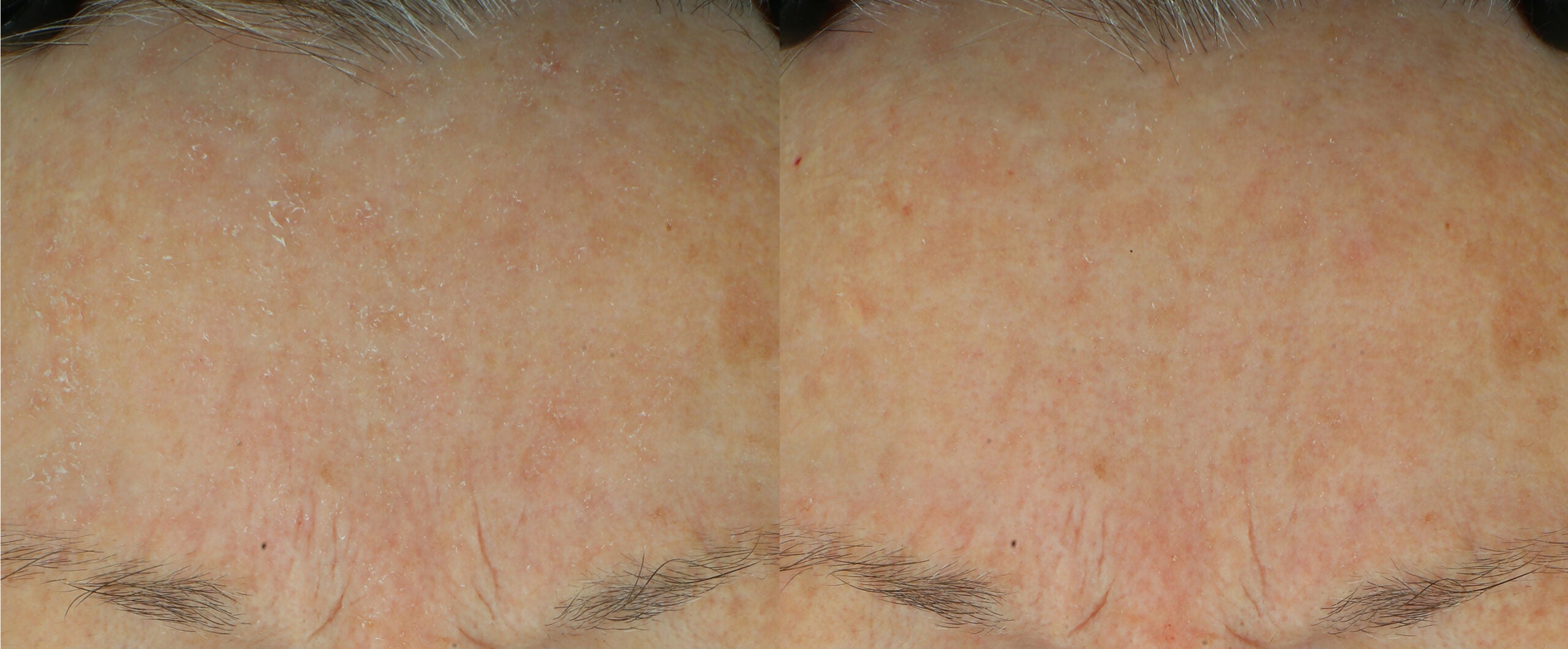 Murad Exasoothe Daily Defense Cream