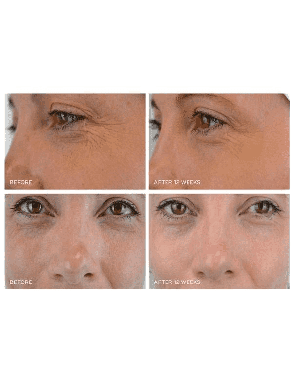 Medik8 Crystal Retinal 10
