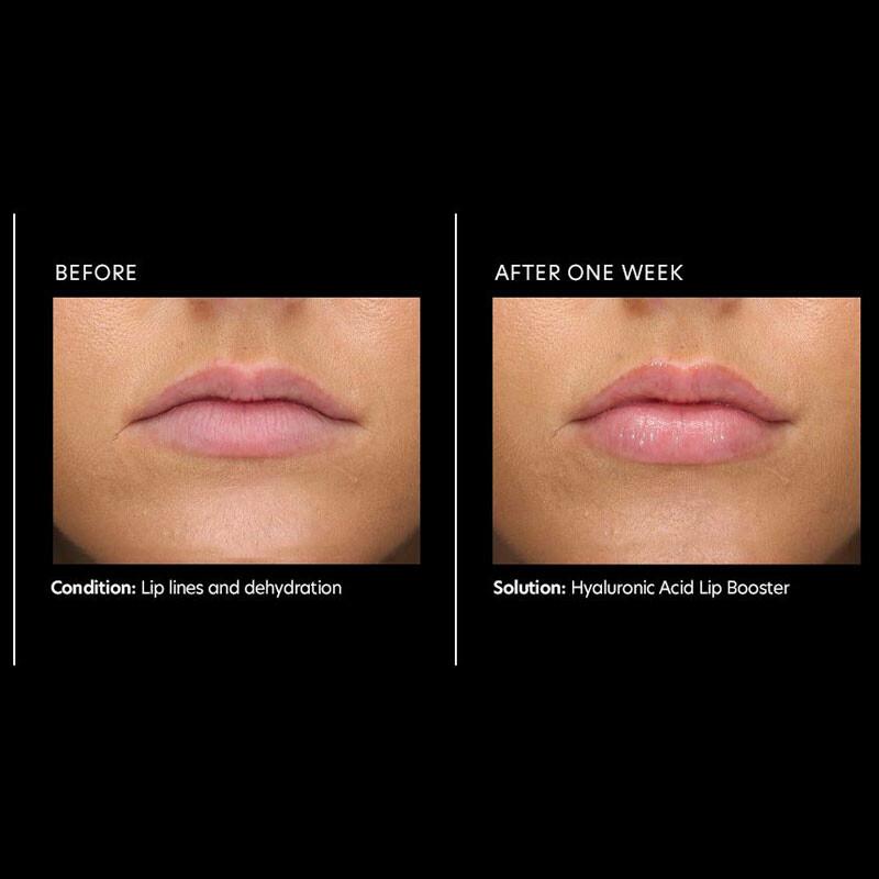 PCA Skin Hyaluronic Acid Lip Booster