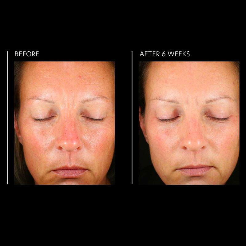 PCA Skin Hyaluronic Acid Overnight Mask